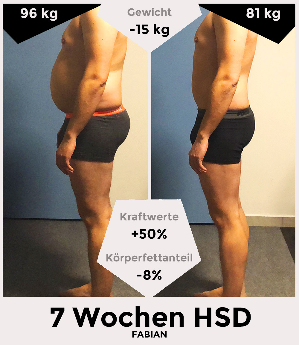 Fabian vor und nach der HSD - seitlich